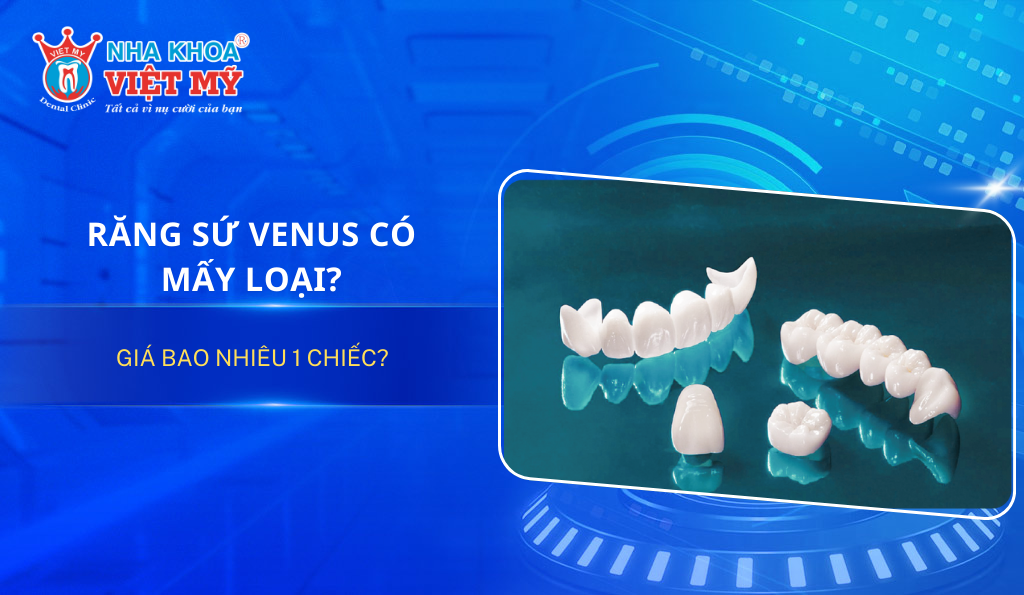 Răng sứ venus có mấy loại? Giá bao nhiêu 1 chiếc?