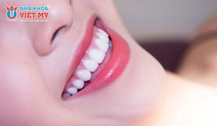 Trồng răng sứ không bảo hành trọn đời tuyệt đối mà áp dụng thời gian bảo hành cụ thể cho trụ Implant và mão sứ.