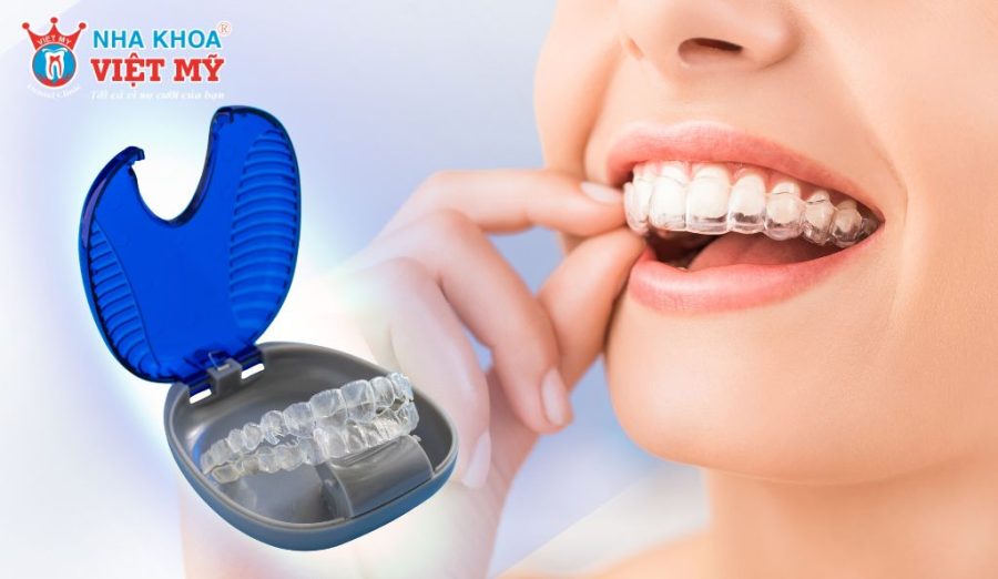 Niềng răng trong suốt mang lại tính thẩm mỹ cao và thuận tiện khi sinh hoạt