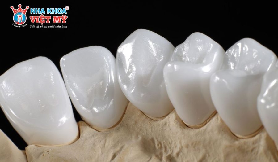 Nha khoa Việt Mỹ là địa chỉ làm răng sứ Diamond chất lượng, bền đẹp