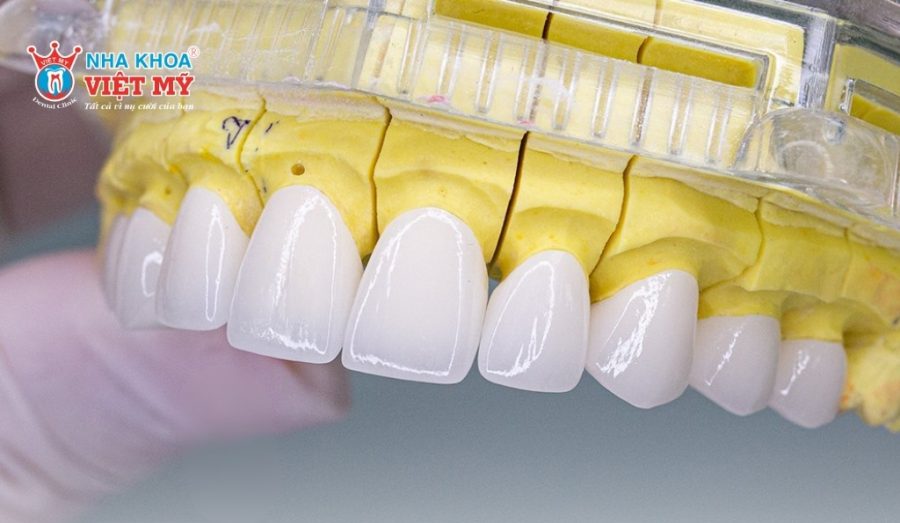 Răng sứ Nacera được sản xuất theo tiêu chuẩn nghiêm ngặt