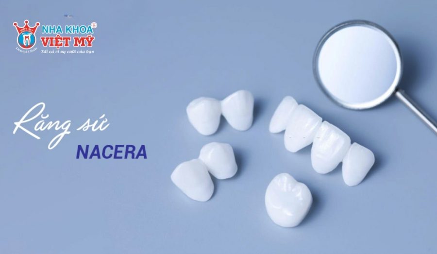 Tham khảo bọc sứ Nacera và phương pháp khác