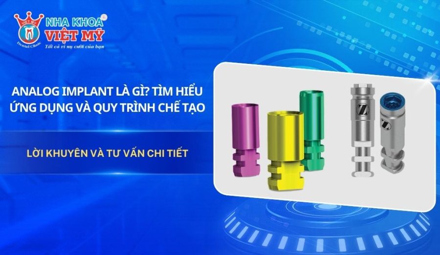 Analog implant là gì? Tìm hiểu ứng dụng và quy trình chế tạo