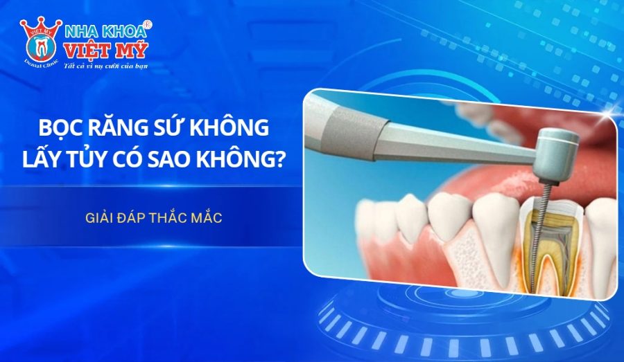 [Giải đáp] Bọc răng sứ không lấy tủy có sao không?