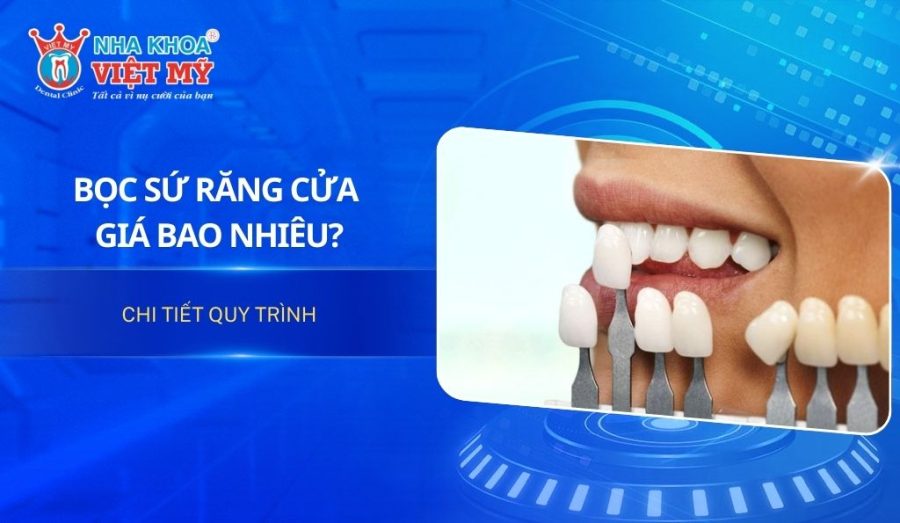 Bọc sứ răng cửa giá bao nhiêu? Chi tiết quy trình
