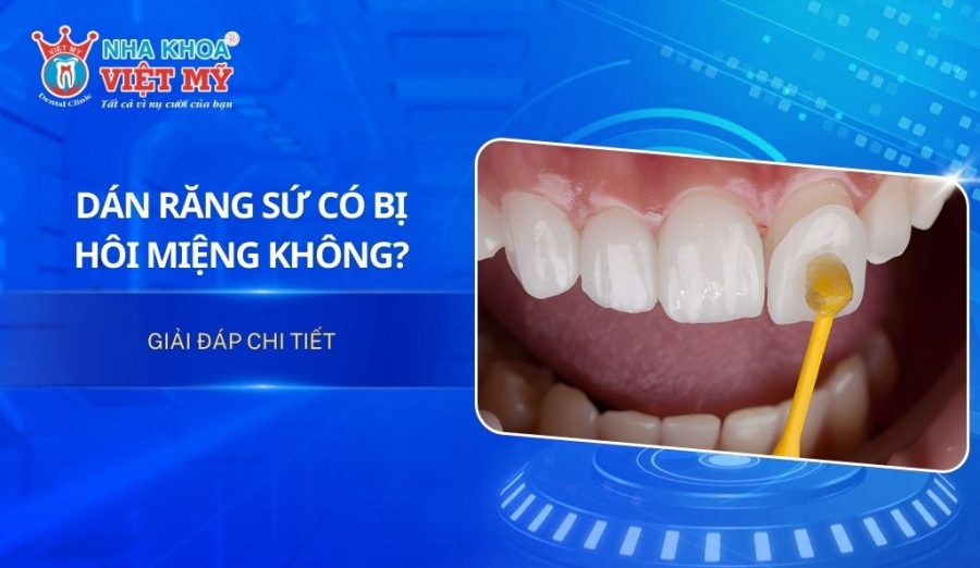 [Giải đáp] Dán sứ veneer có bị hôi miệng không?