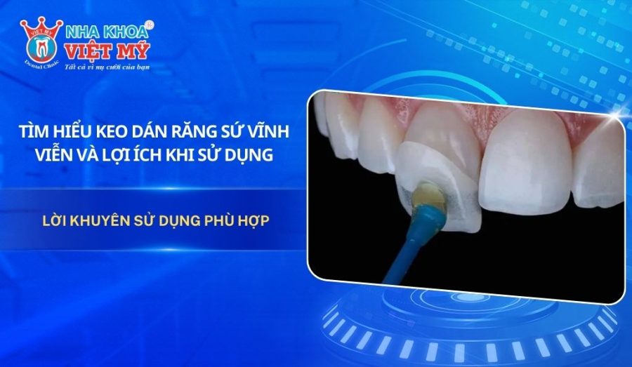 Tìm hiểu keo dán răng sứ vĩnh viễn và lợi ích khi sử dụng