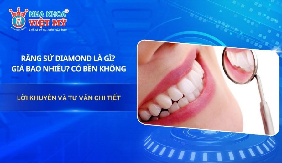 Răng sứ Diamond là gì? Giá bao nhiêu? Có bền không