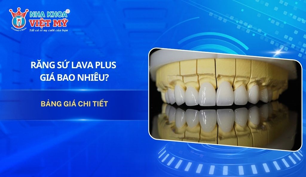 Răng sứ Lava Plus giá bao nhiêu? Bảng giá chi tiết