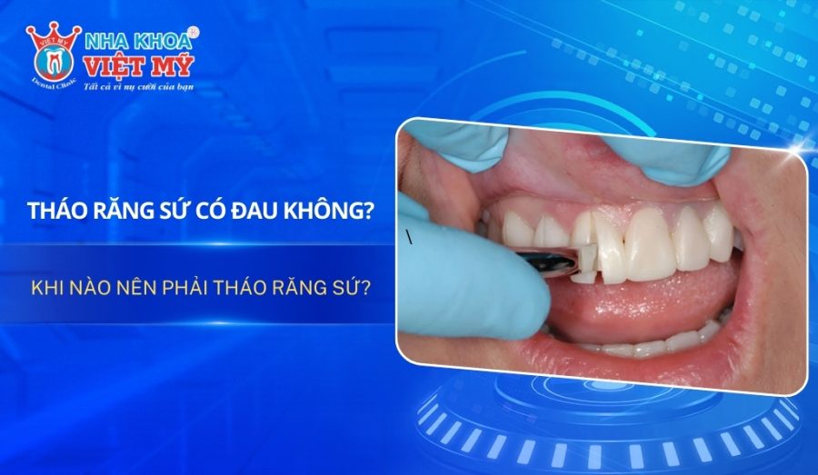 Tháo răng sứ có đau không? Khi nào nên phải tháo răng sứ