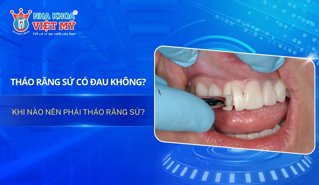 Tháo răng sứ có đau không? Khi nào nên phải tháo răng sứ
