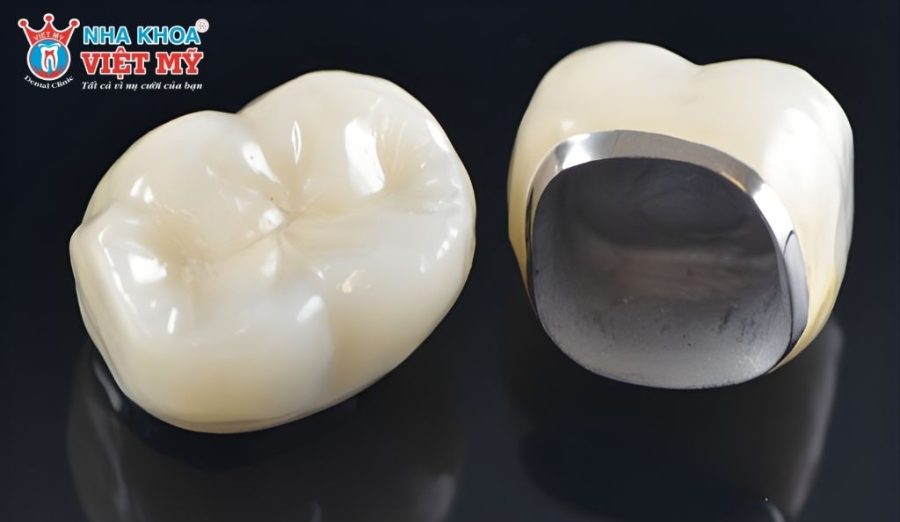 Chọn vật liệu làm răng sứ phù hợp sẽ đảm bảo răng bền đẹp hơn