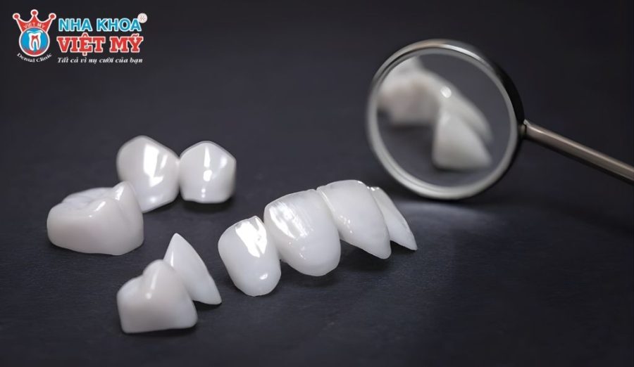 Mão sứ kim loại có cấu tạo phần khung sườn từ hợp kim và phủ một lớp sứ bên ngoài