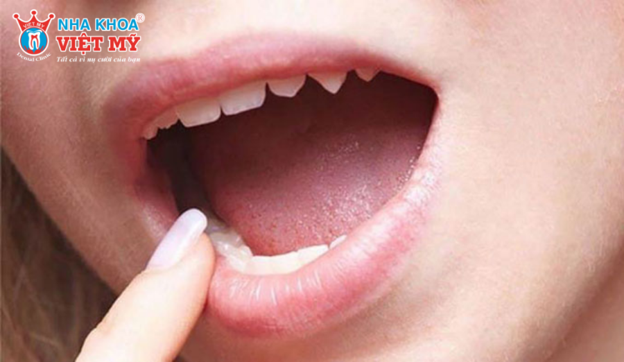 Phương pháp dùng tay đẩy răng hô chỉ phù hợp với trẻ em từ 6 - 12 tuổi