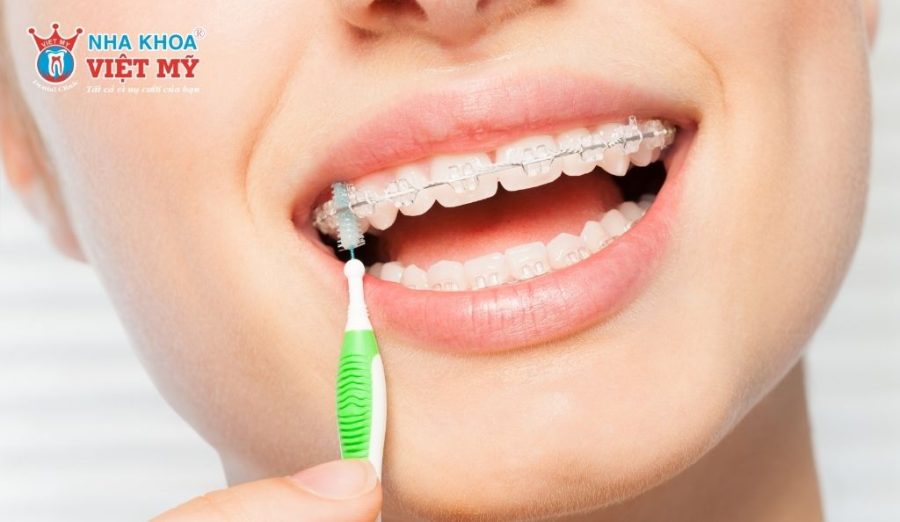 Chải răng theo chiều dọc, làm sạch lần lượt mặt ngoài, mặt trong và mặt nhai của răng