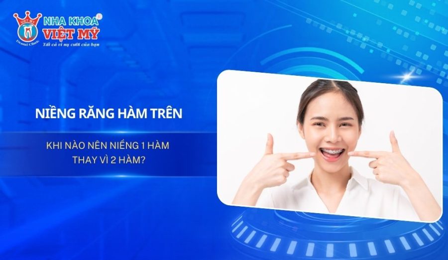 Niềng răng hàm trên - Khi nào nên niềng 1 hàm thay vì 2 hàm?