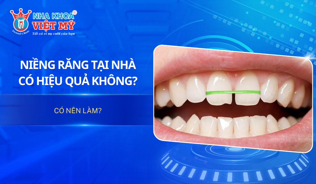 Niềng răng tại nhà có hiệu quả không? Có nên làm?