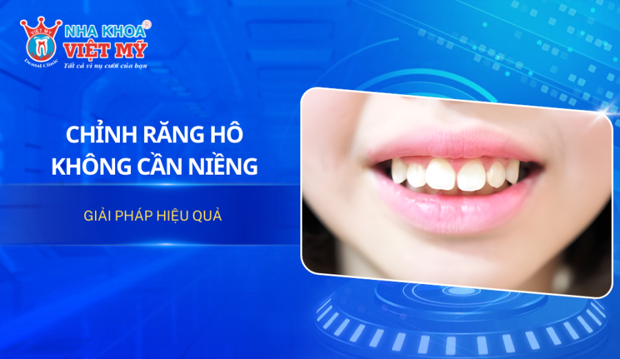 Chỉnh răng hô không cần niềng: Giải pháp hiệu quả