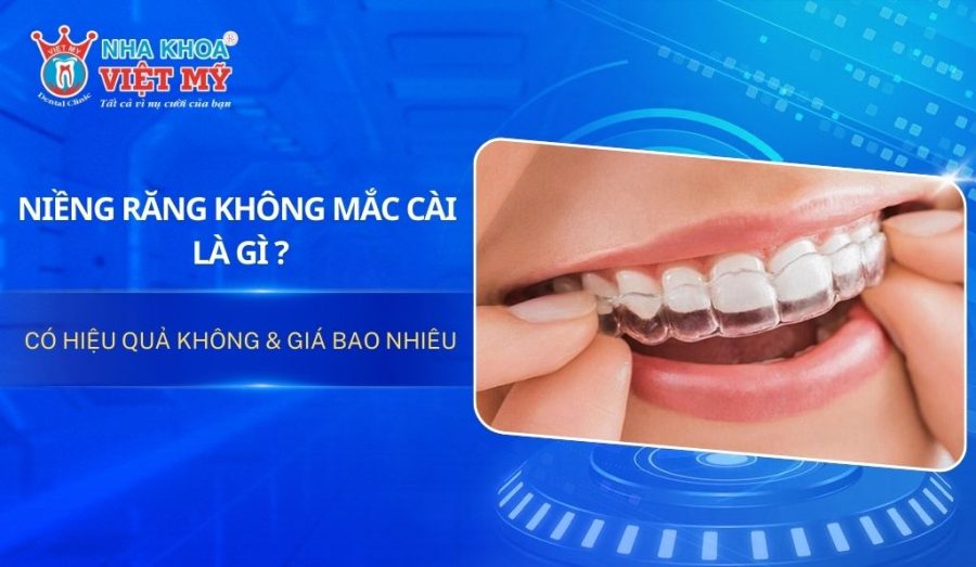 Niềng răng không mắc cài là gì? Có hiệu quả không & giá bao nhiêu?