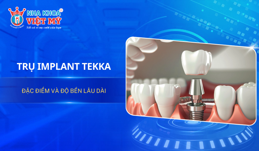 Trụ Implant Tekka: Đặc điểm và độ bền lâu dài