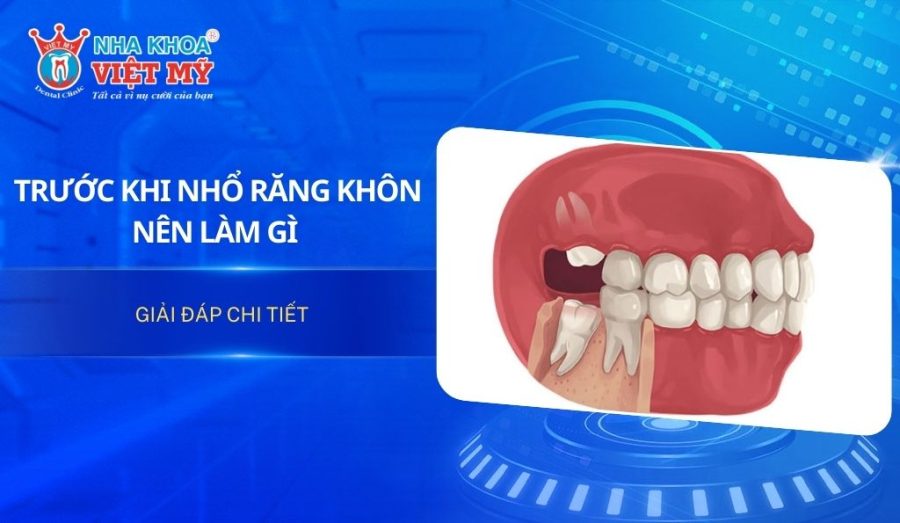 Trước khi nhổ răng khôn, người bệnh cần thăm khám và chuẩn bị kỹ lưỡng để hạn chế đau và biến chứng