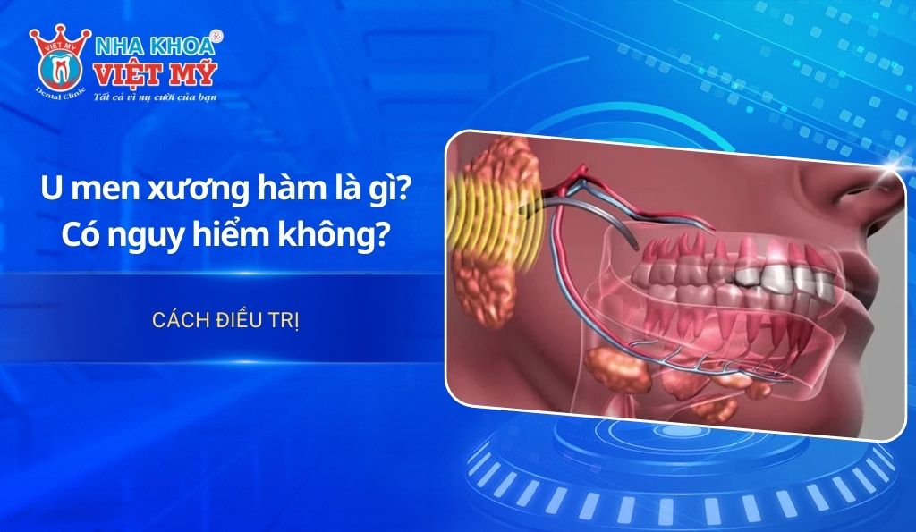 U men xương hàm là gì? Có nguy hiểm không và cách điều trị