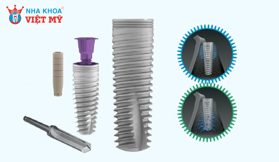 Trụ Implant MIS C1 được thiết kế theo tiêu chuẩn quốc tế