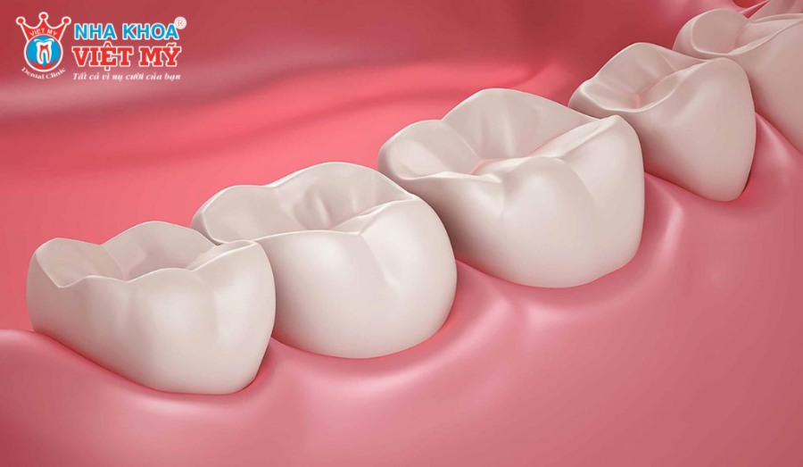 Việc có 28 cái răng không phải điều gì bất thường cũng như sẽ ảnh hưởng đến sức khỏe
