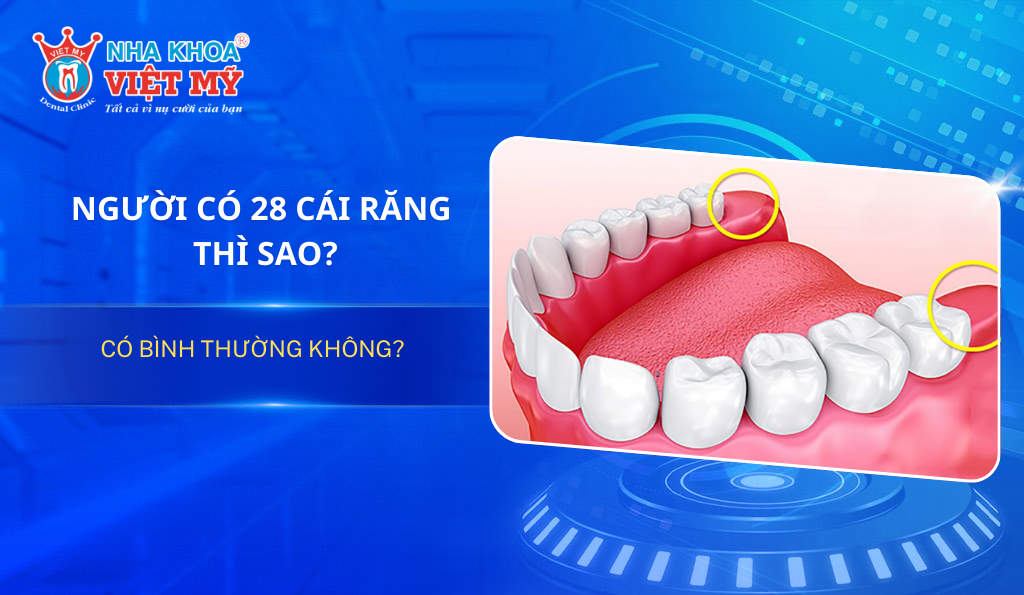 Người có 28 cái răng thì sao? Có bình thường không?
